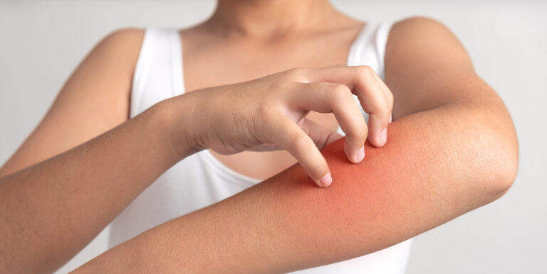 10-most-common-skin-diseases-featured-image